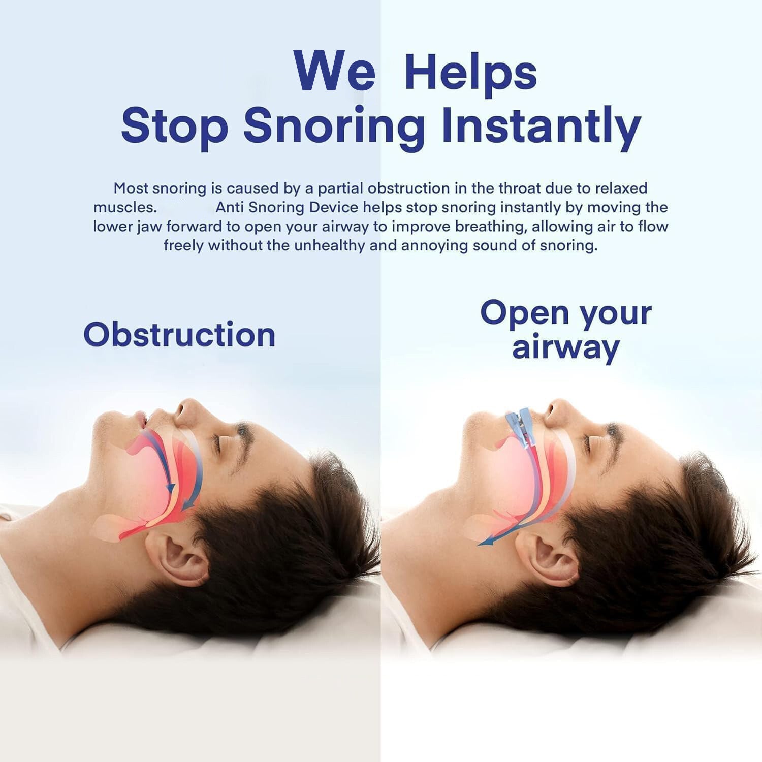 Help with Sleep Anti-Snoring Mouthpiece Stop Snoringbruxism Apnea Breathing 1Pcs